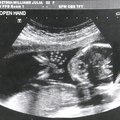 ultrasound_2.jpg