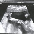 ultrasound_3.jpg