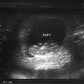ultrasound_1_1.jpg