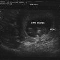 ultrasound_1_4.jpg