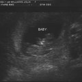 ultrasound_1_5.jpg
