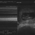 ultrasound_1_6.jpg