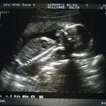 ultrasound_2_2.jpg