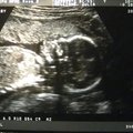ultrasound_2_3.jpg