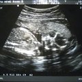 ultrasound_2_4.jpg